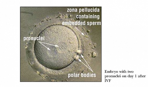 Observation of Fertilization after insemination in IVF