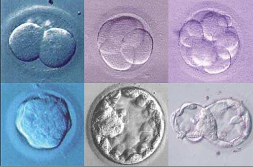 Stages of division of the fertilized ovum during IVF
