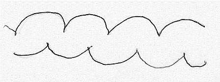 Haustrations in the large bowel