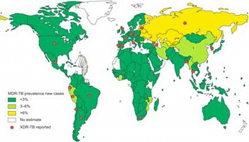 Multidrug resistant tuberculosis prevalence and incidence worldwide