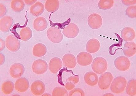 Trypanosomes (Trypomastigotes seen in a blood smear) - this is a method of diagnosis of trypanosomiasis