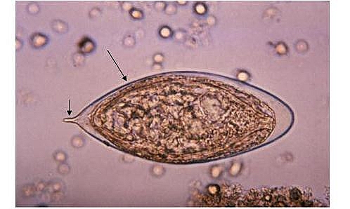 Schistosoma egg: The eggs can be easily distinguished by their spines. Schistosoma hematobium egg has terminal spine; Schistosoma mansoni egg has large lateral spine