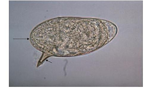 Schistosoma mansoni egg with lateral spine