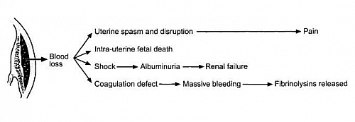 Placental abruption Complications