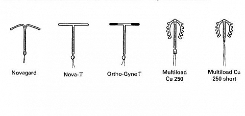 Copper T types and other types of Copper IUDs