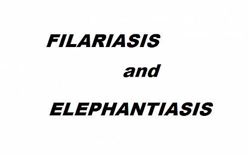 Elephantiasis of the legs