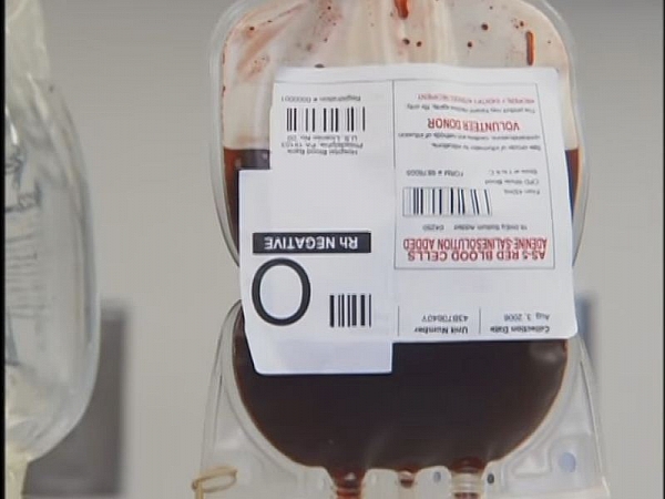 Photo of Blood transfusion: Procedure, Complications and types of Components
