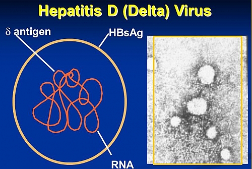 Photo of Hepatitis D infection: Symptoms, Transmission, Treatment and Diagnosis