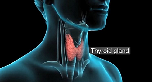 Photo of Hashimotos Thyroiditis Disease: Symptoms, Diagnosis, Treatment/Cure, and Diet