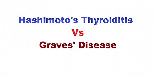 Photo of Differences between Graves disease and Hashimoto